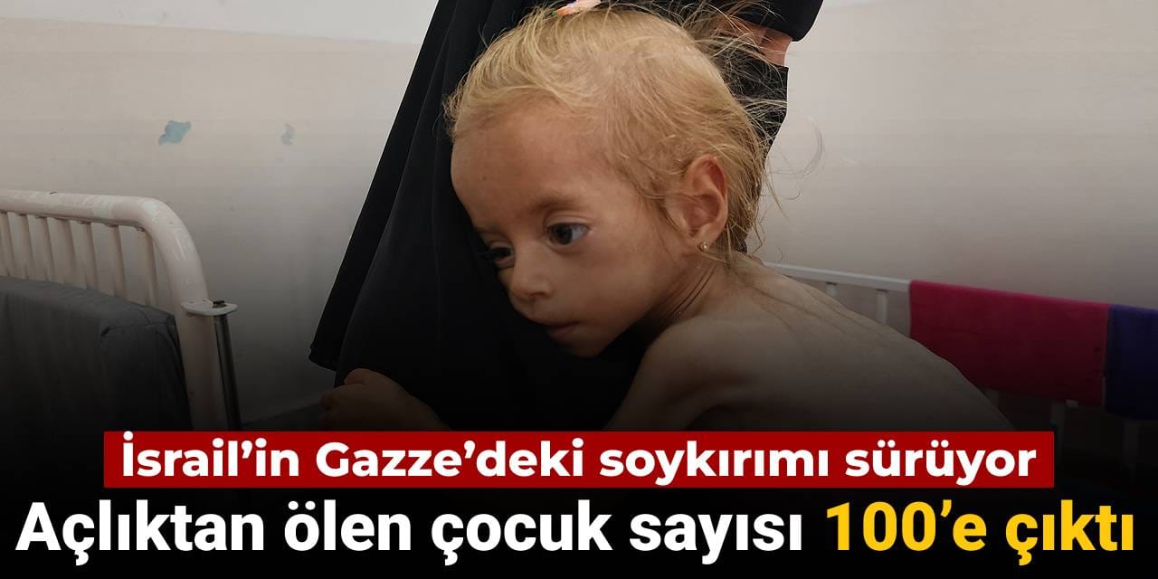 Gazze’de açlıktan ölen çocuk sayısı 100’e çıktı